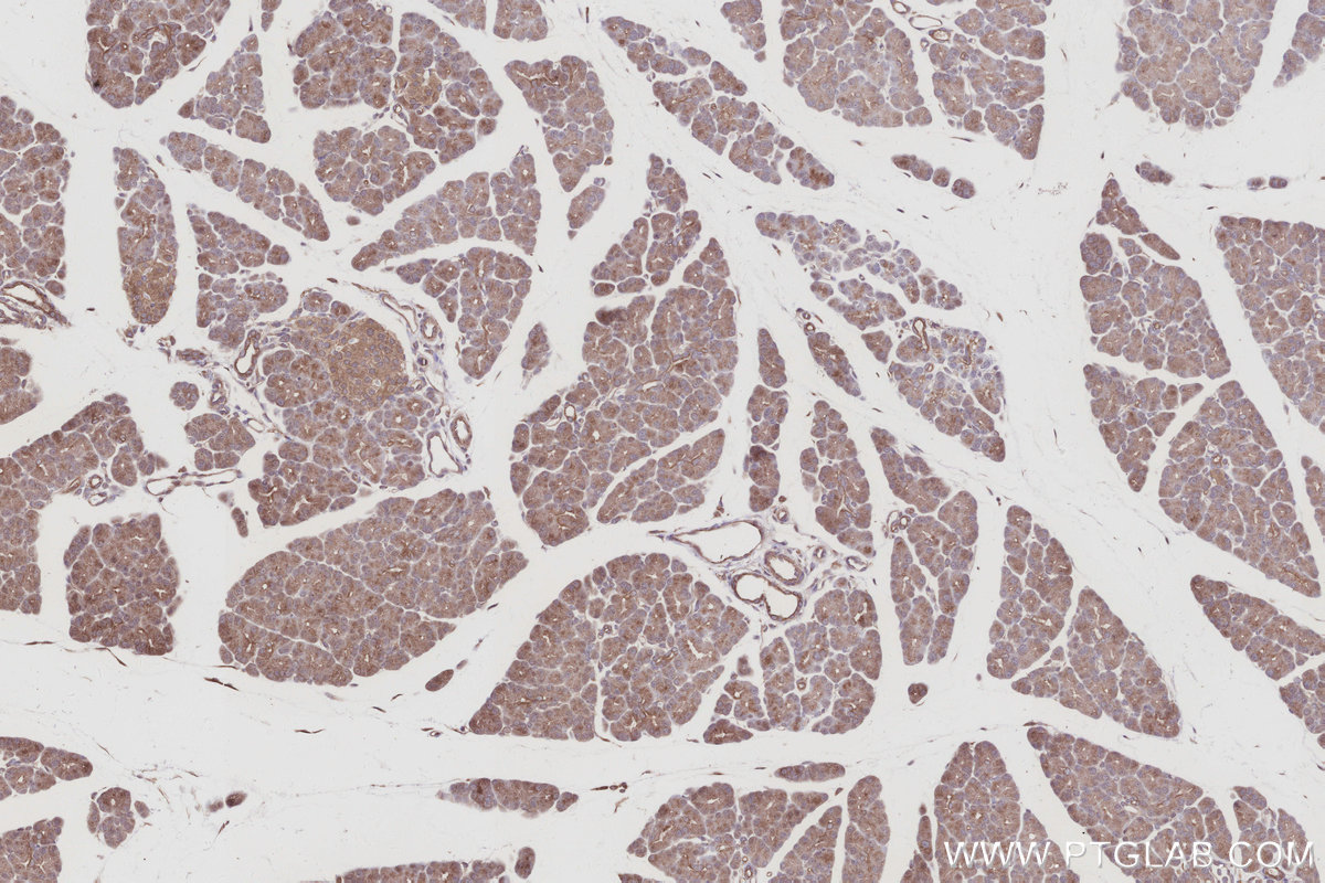 Immunohistochemical analysis of paraffin-embedded rat pancreas tissue slide using KHC3018 (TUBD1 IHC Kit). Immunohistochemical analysis of paraffin-embedded rat pancreas tissue slide using KHC3018 (TUBD1 IHC Kit).