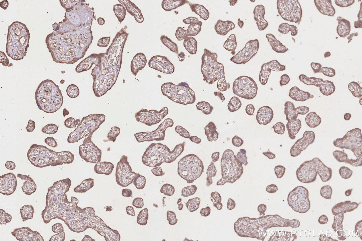 Immunohistochemical analysis of paraffin-embedded human placenta tissue slide using KHC2829 (TUBGCP5 IHC Kit).