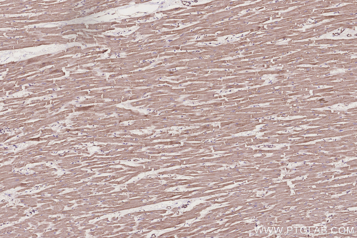 Immunohistochemical analysis of paraffin-embedded human heart tissue slide using KHC3251 (TUSC3 IHC Kit).