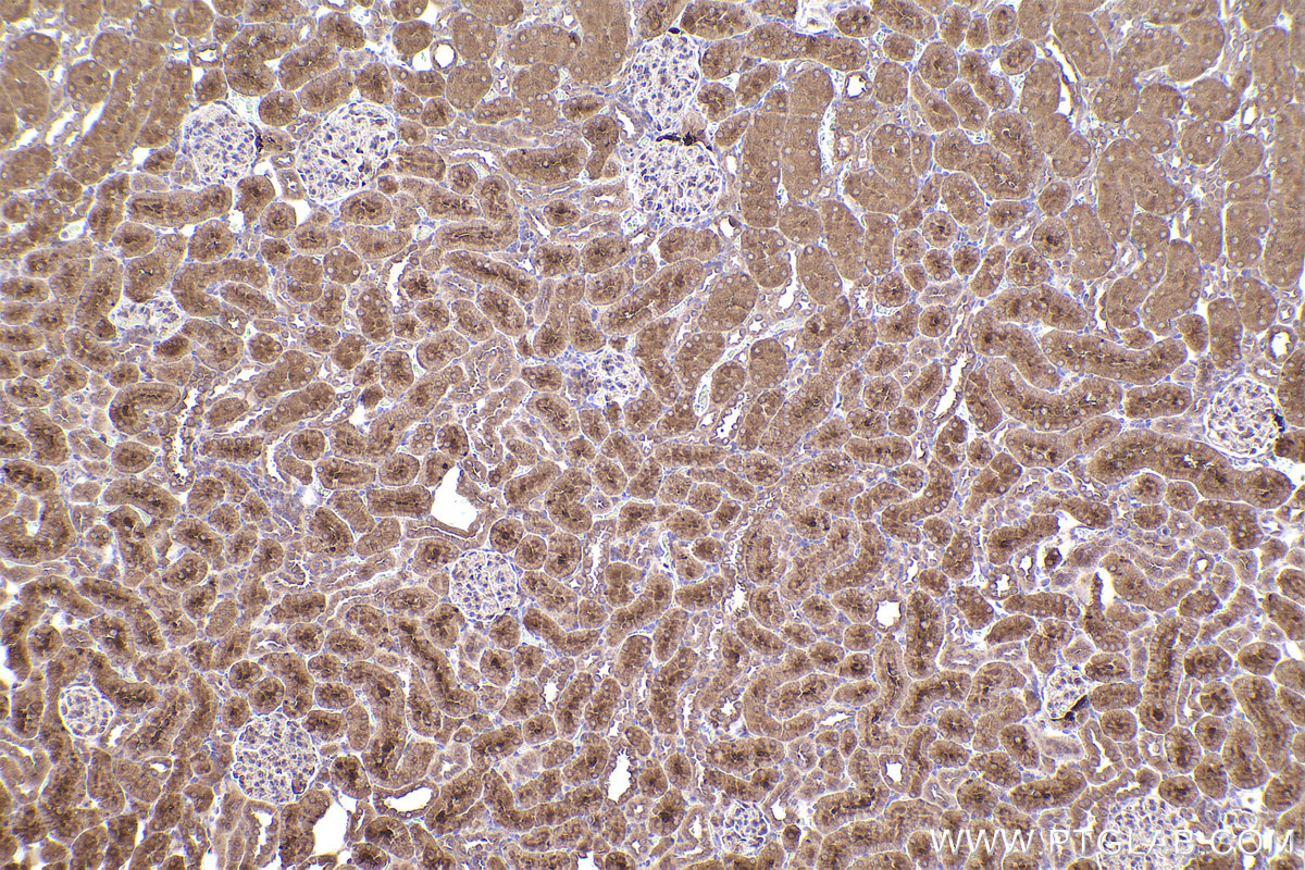 Immunohistochemical analysis of paraffin-embedded rat kidney tissue slide using KHC2407 (TWF1 IHC Kit).