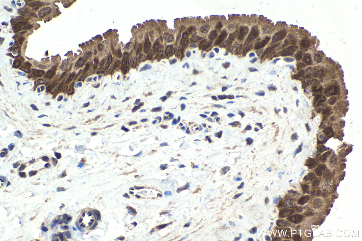 Immunohistochemical analysis of paraffin-embedded rat bladder tissue slide using KHC1844 (TWIST2 IHC Kit).