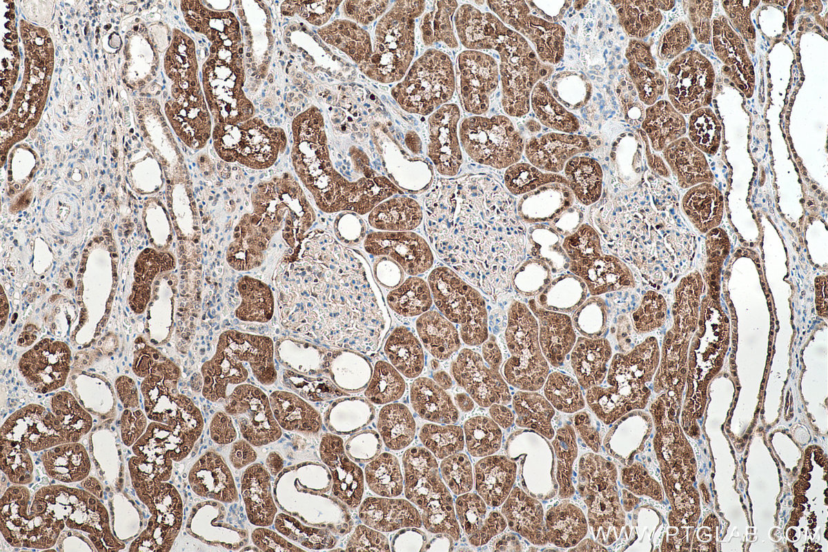 Immunohistochemical analysis of paraffin-embedded human kidney tissue slide using KHC0529 (TXN IHC Kit).