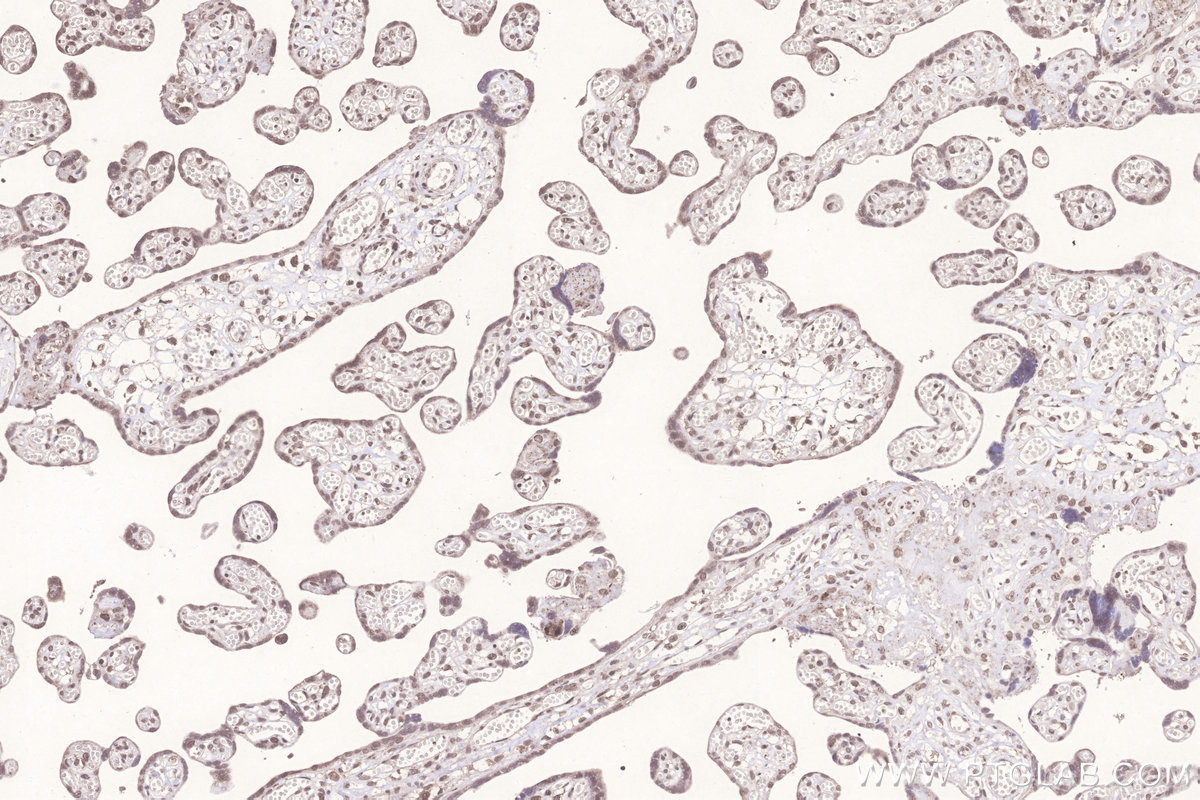 Immunohistochemical analysis of paraffin-embedded human placenta tissue slide using KHC3283 (TXNRD3 IHC Kit).