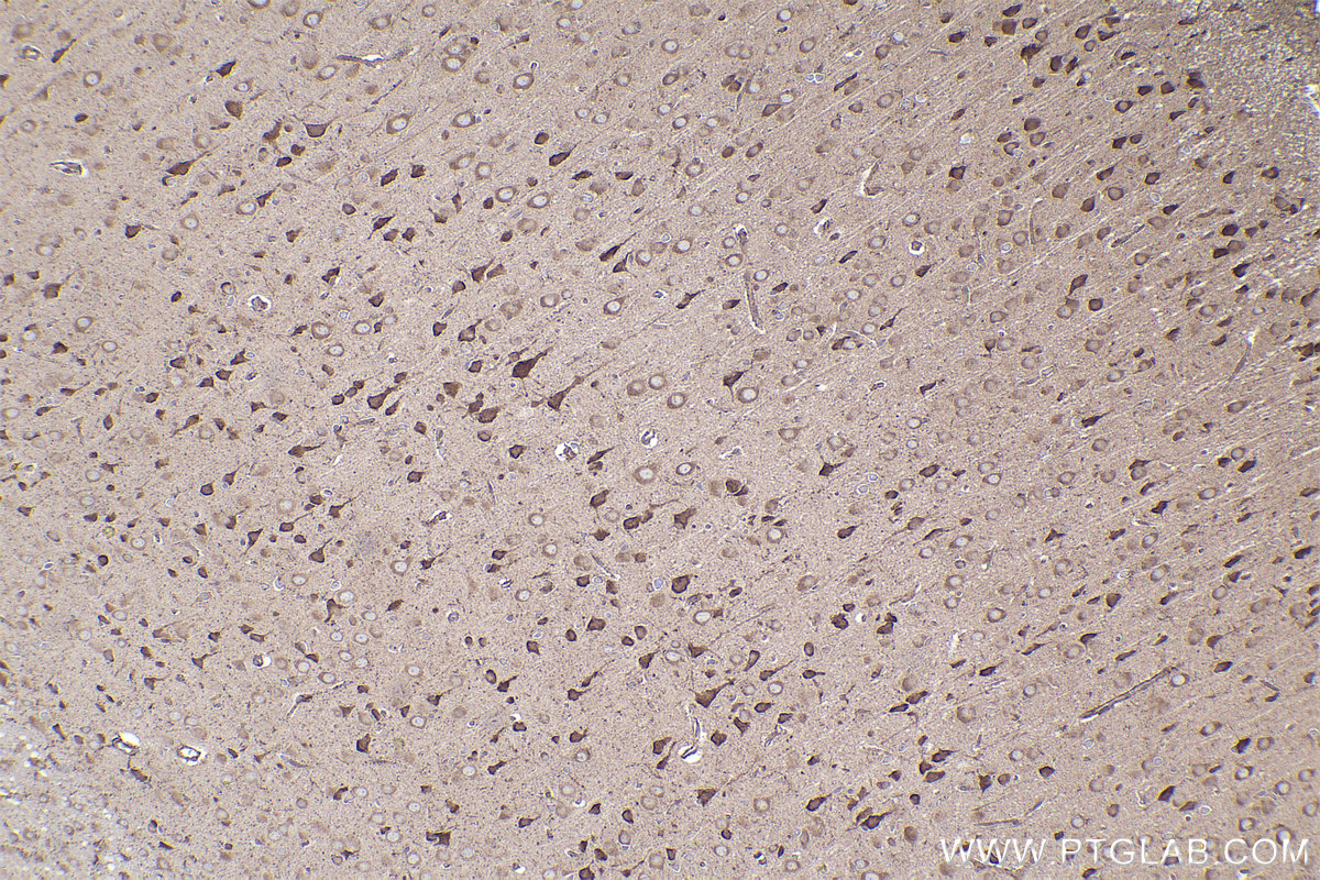Immunohistochemical analysis of paraffin-embedded rat brain tissue slide using KHC2395 (TYRO3 IHC Kit).