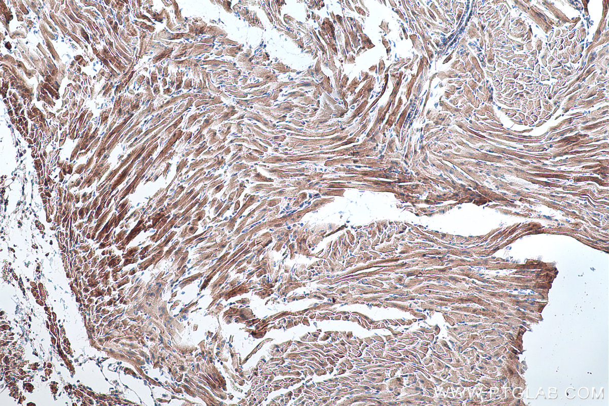 Immunohistochemical analysis of paraffin-embedded mouse heart tissue slide using KHC0312 (Telethonin IHC Kit).