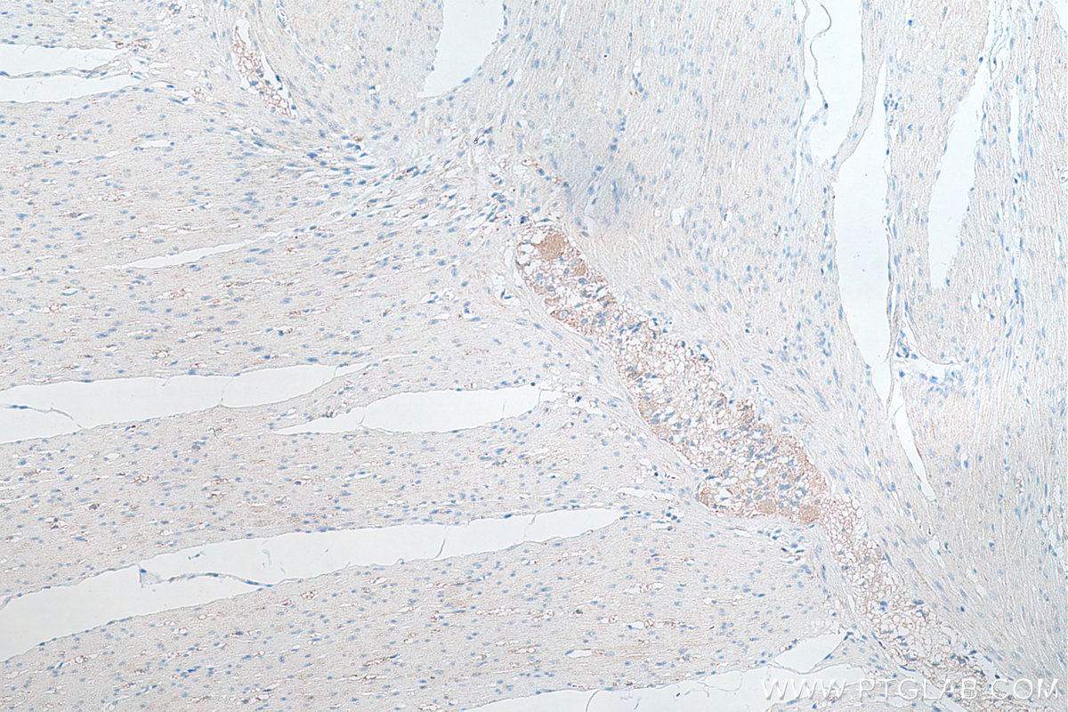 Immunohistochemical analysis of paraffin-embedded human colon(NAT) tissue slide using KHC0312 (Telethonin IHC Kit).