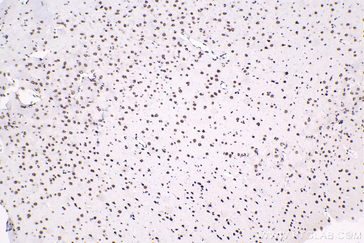 Immunohistochemical analysis of paraffin-embedded mouse brain tissue slide using KHC1661 (U2AF1 IHC Kit).