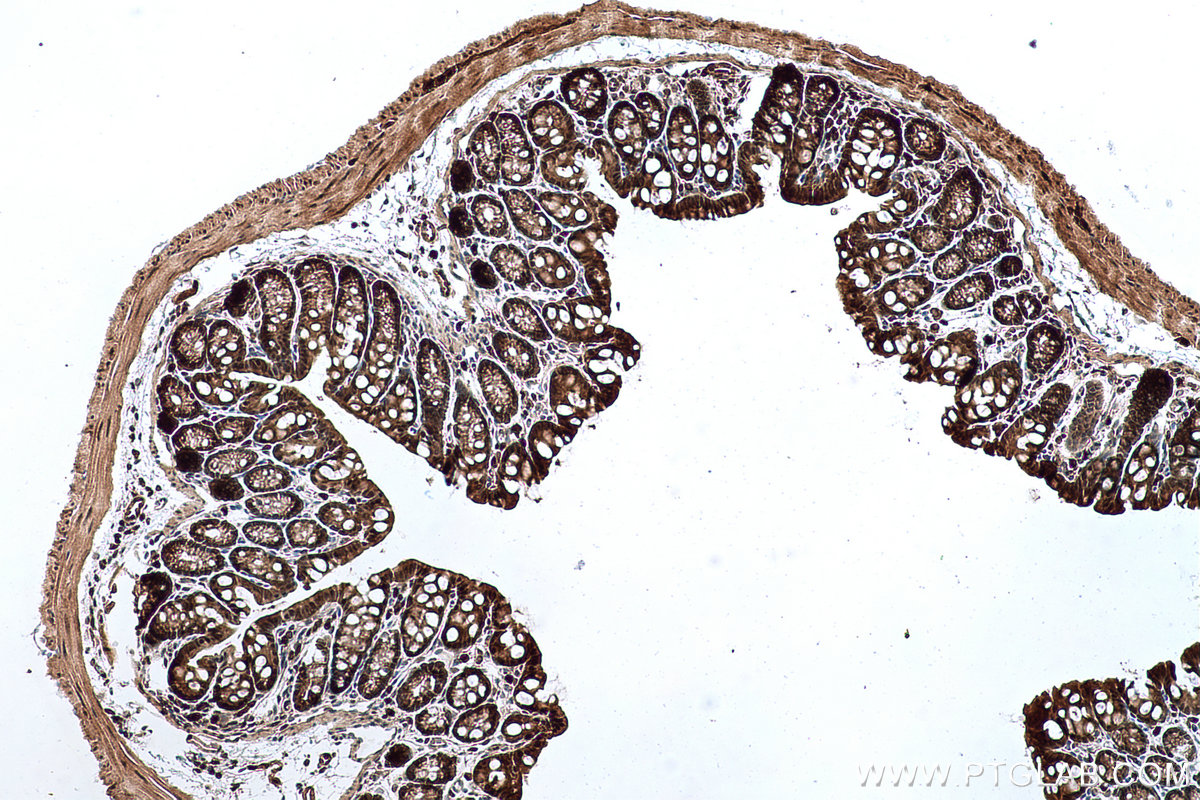 Immunohistochemical analysis of paraffin-embedded mouse colon tissue slide using KHC0679 (UBA1 IHC Kit).