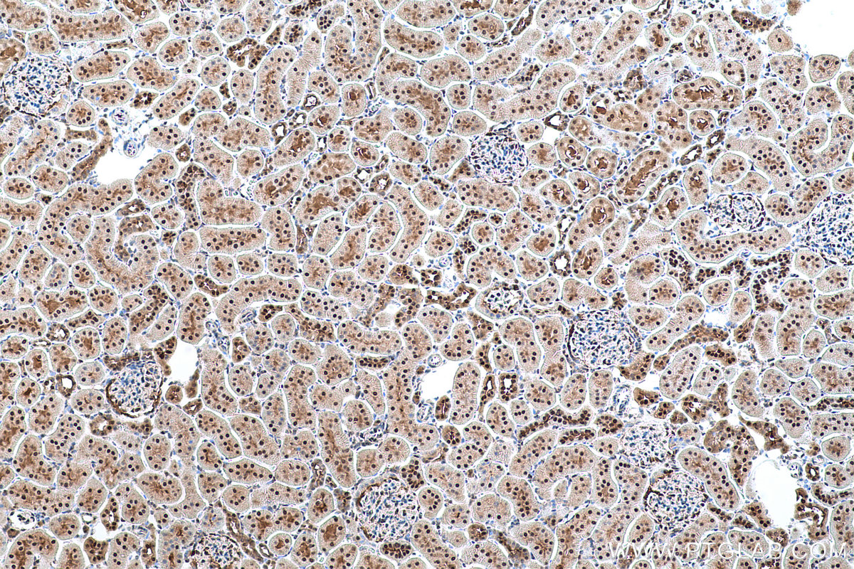 Immunohistochemical analysis of paraffin-embedded rat kidney tissue slide using KHC0679 (UBA1 IHC Kit).