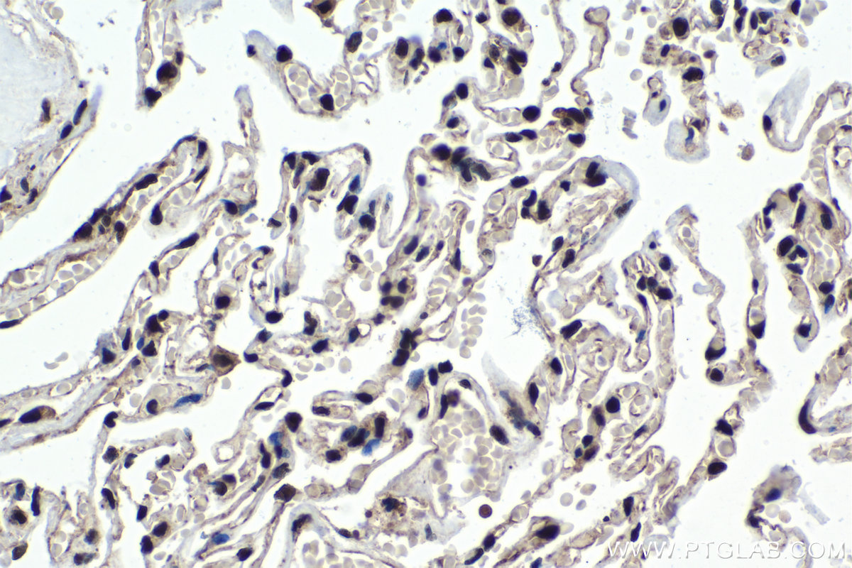 Immunohistochemical analysis of paraffin-embedded human lung tissue slide using KHC1394 (UBA2 IHC Kit).