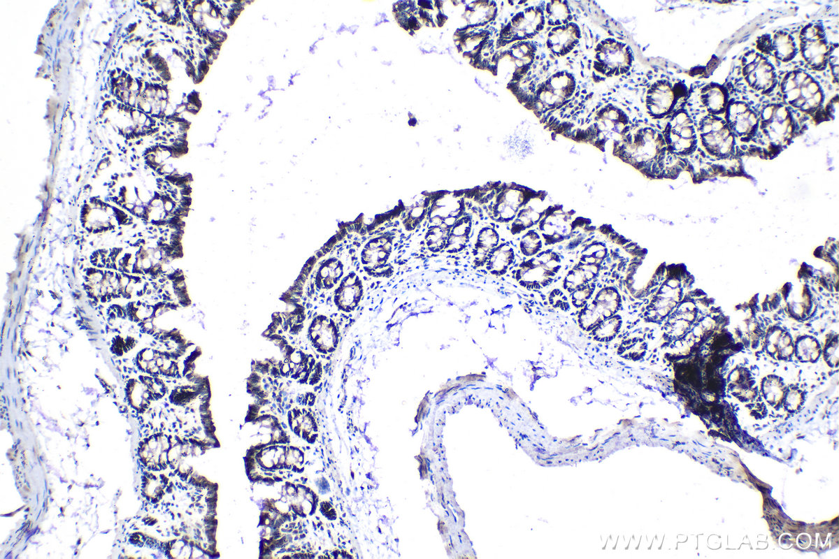 Immunohistochemical analysis of paraffin-embedded rat colon tissue slide using KHC1394 (UBA2 IHC Kit).