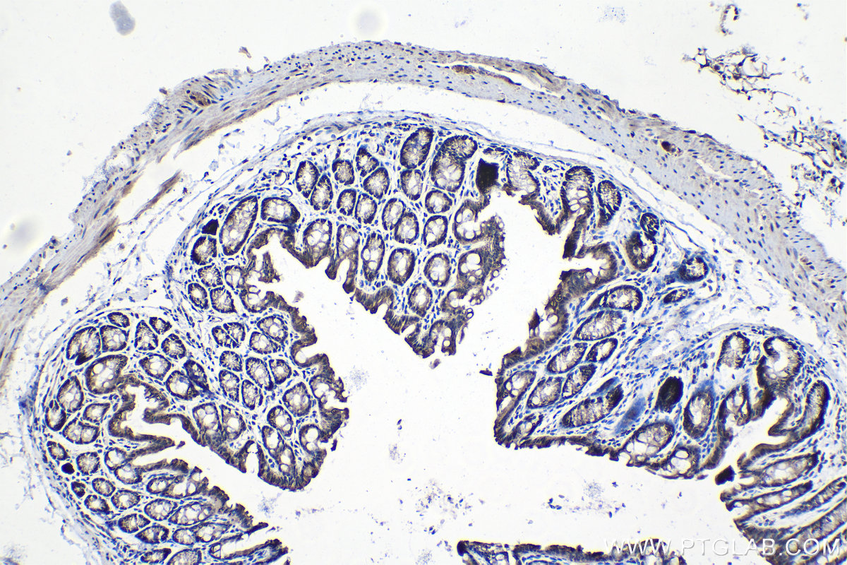 Immunohistochemical analysis of paraffin-embedded mouse colon tissue slide using KHC1394 (UBA2 IHC Kit).