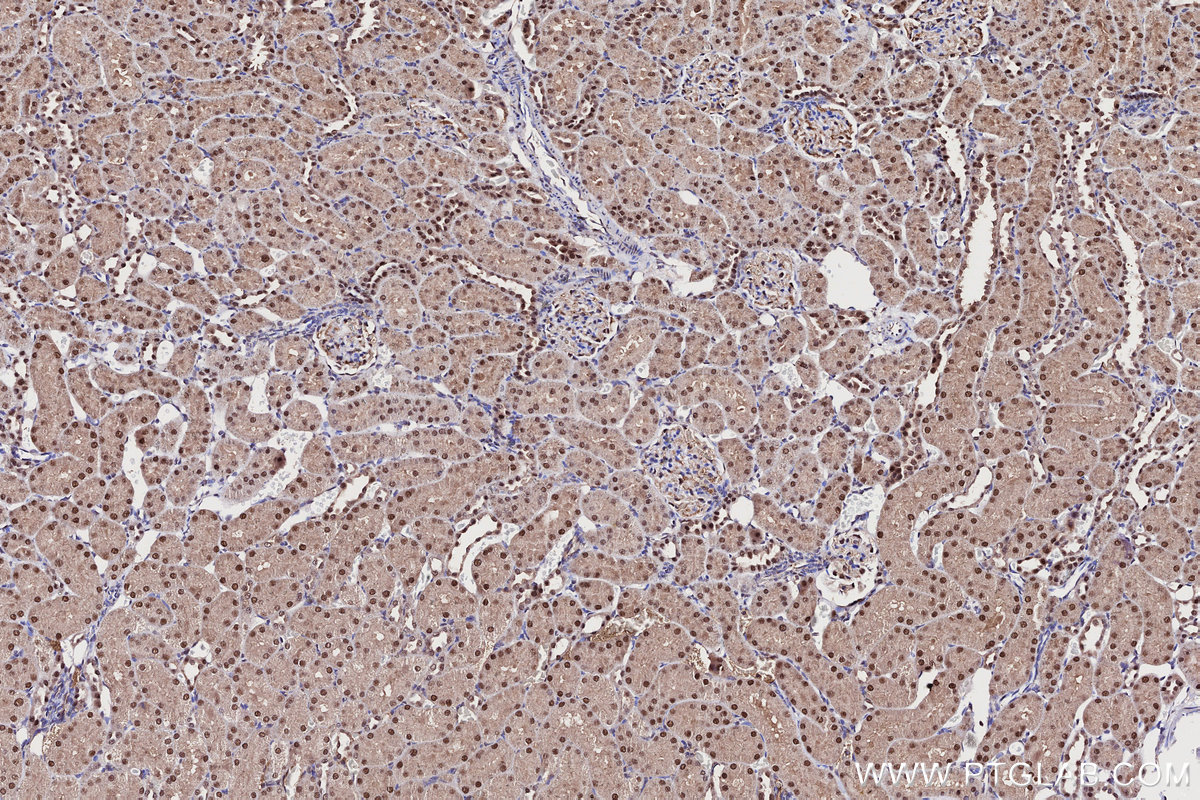 Immunohistochemical analysis of paraffin-embedded rat kidney tissue slide using KHC2708 (UBA3 IHC Kit).