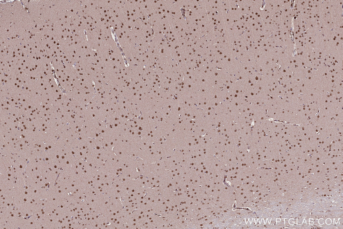 Immunohistochemical analysis of paraffin-embedded rat brain tissue slide using KHC2708 (UBA3 IHC Kit).
