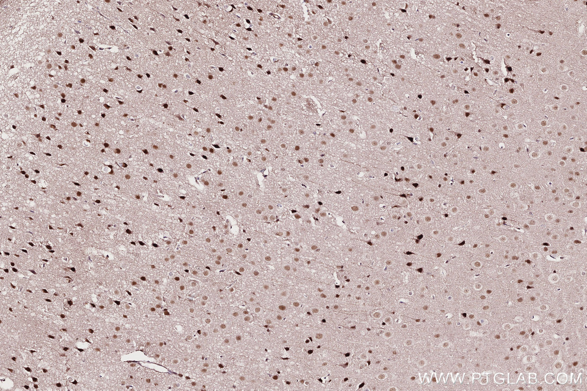 Immunohistochemical analysis of paraffin-embedded mouse brain tissue slide using KHC2708 (UBA3 IHC Kit).