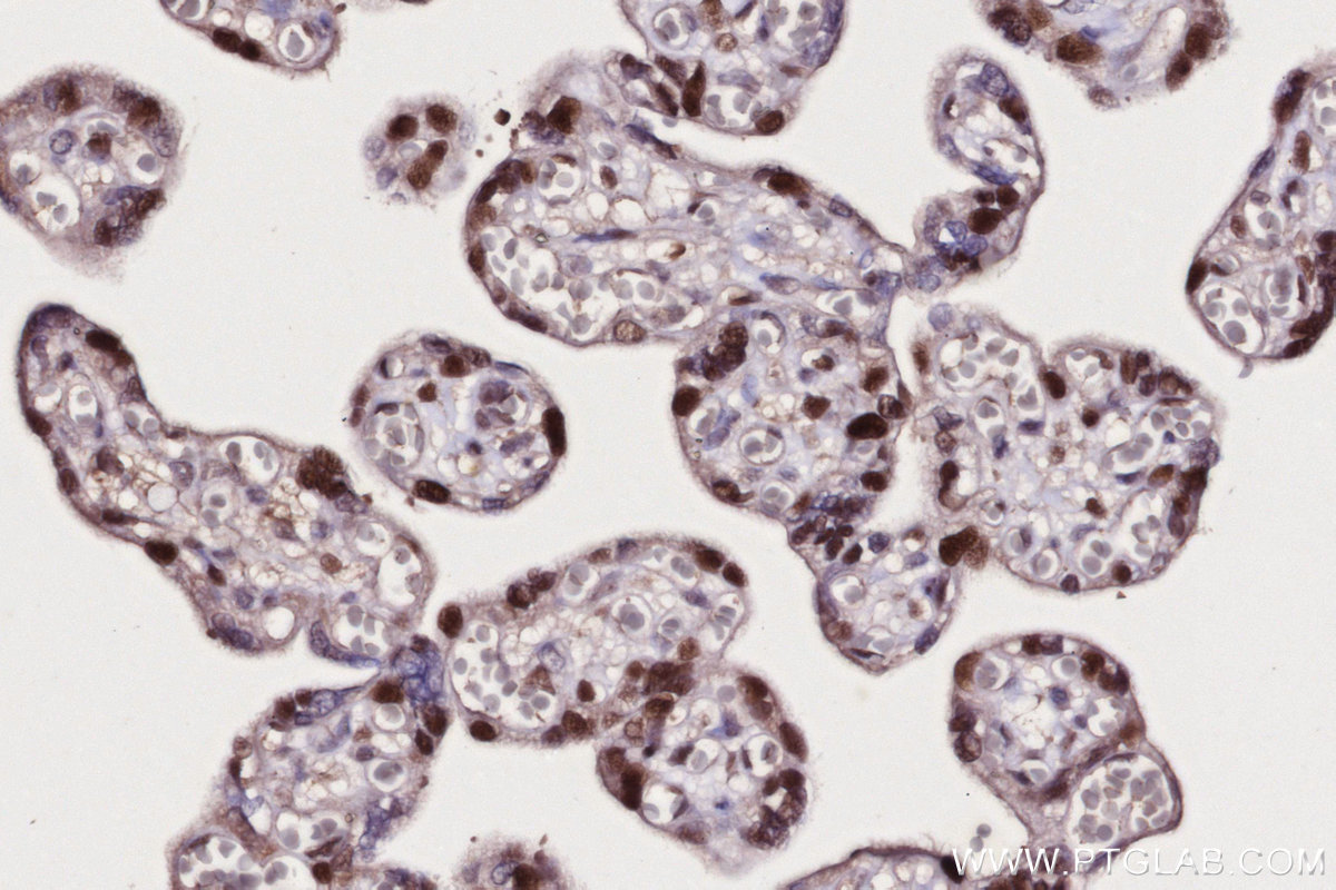 Immunohistochemical analysis of paraffin-embedded human placenta tissue slide using KHC2708 (UBA3 IHC Kit).