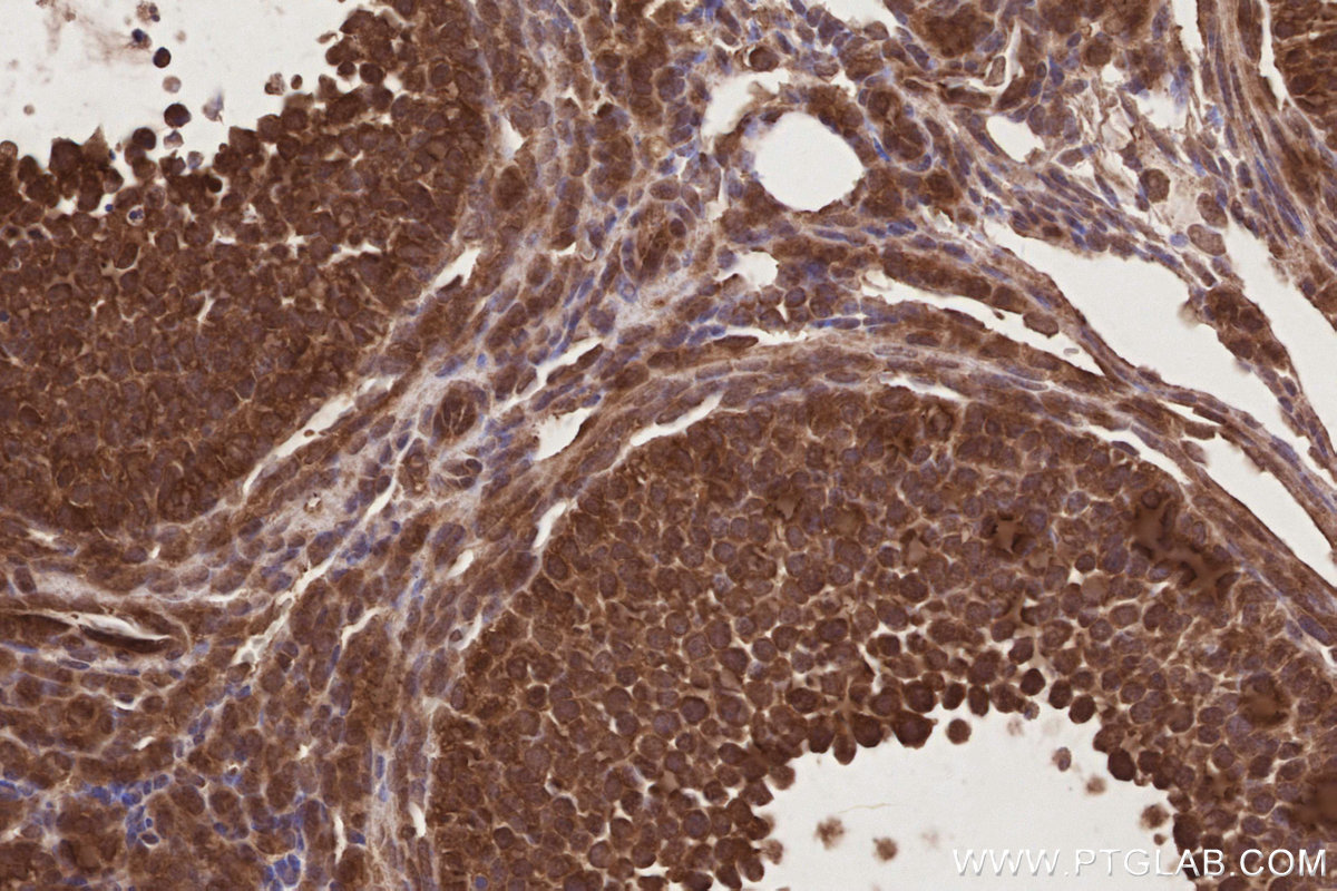 Immunohistochemical analysis of paraffin-embedded mouse ovary tissue slide using KHC2862 (UBAC1 IHC Kit).