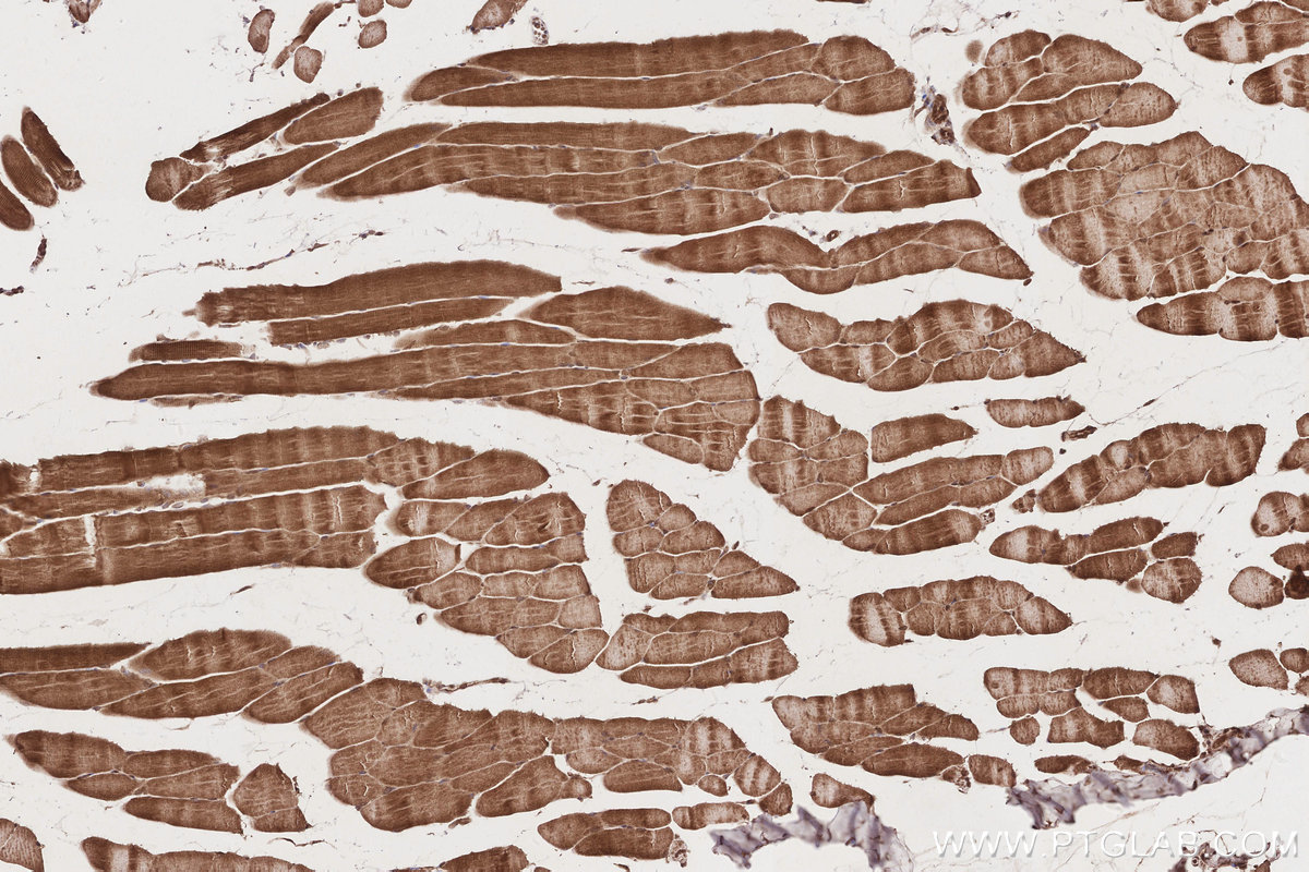 Immunohistochemical analysis of paraffin-embedded mouse skeletal muscle tissue slide using KHC2862 (UBAC1 IHC Kit).