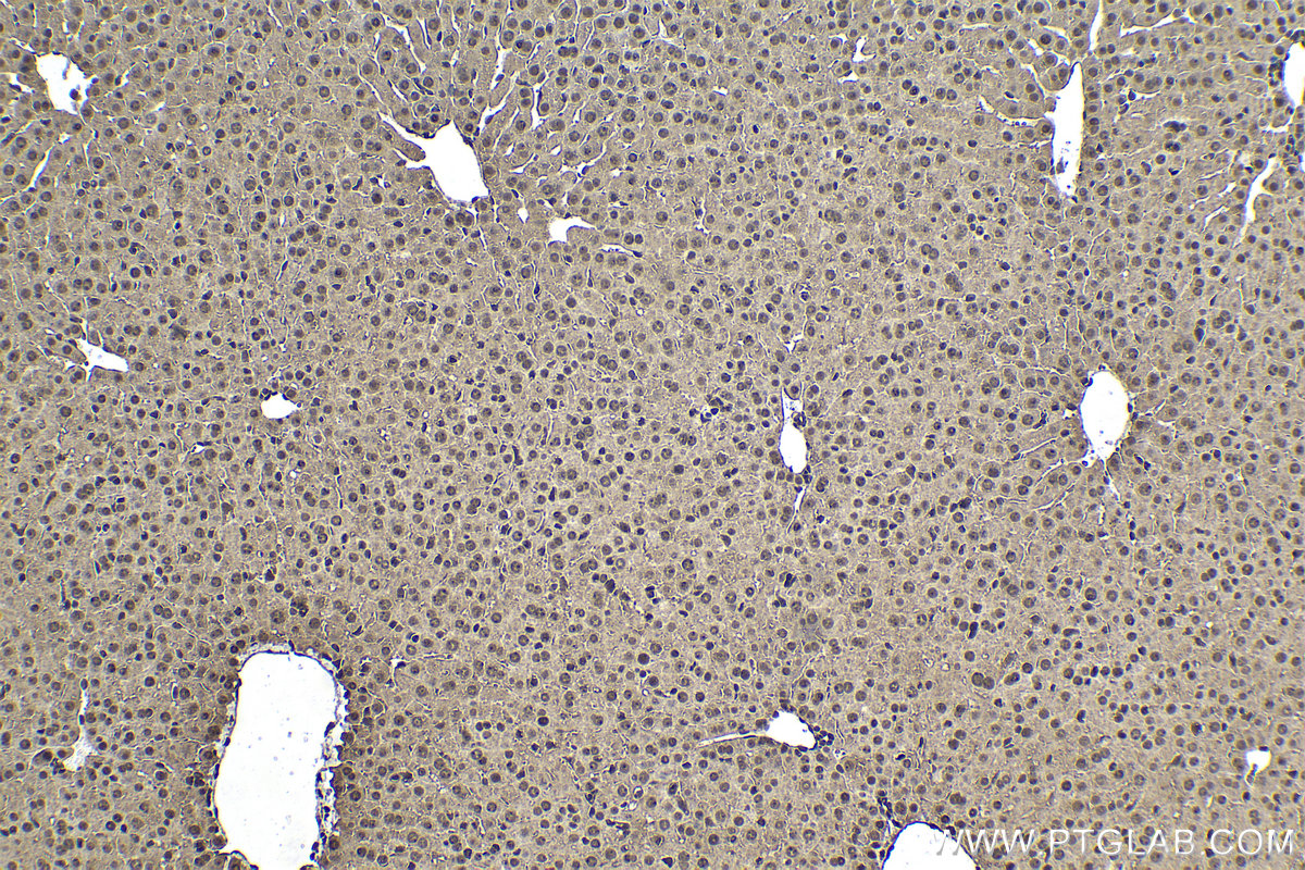 Immunohistochemical analysis of paraffin-embedded mouse liver tissue slide using KHC1518 (UBB IHC Kit).