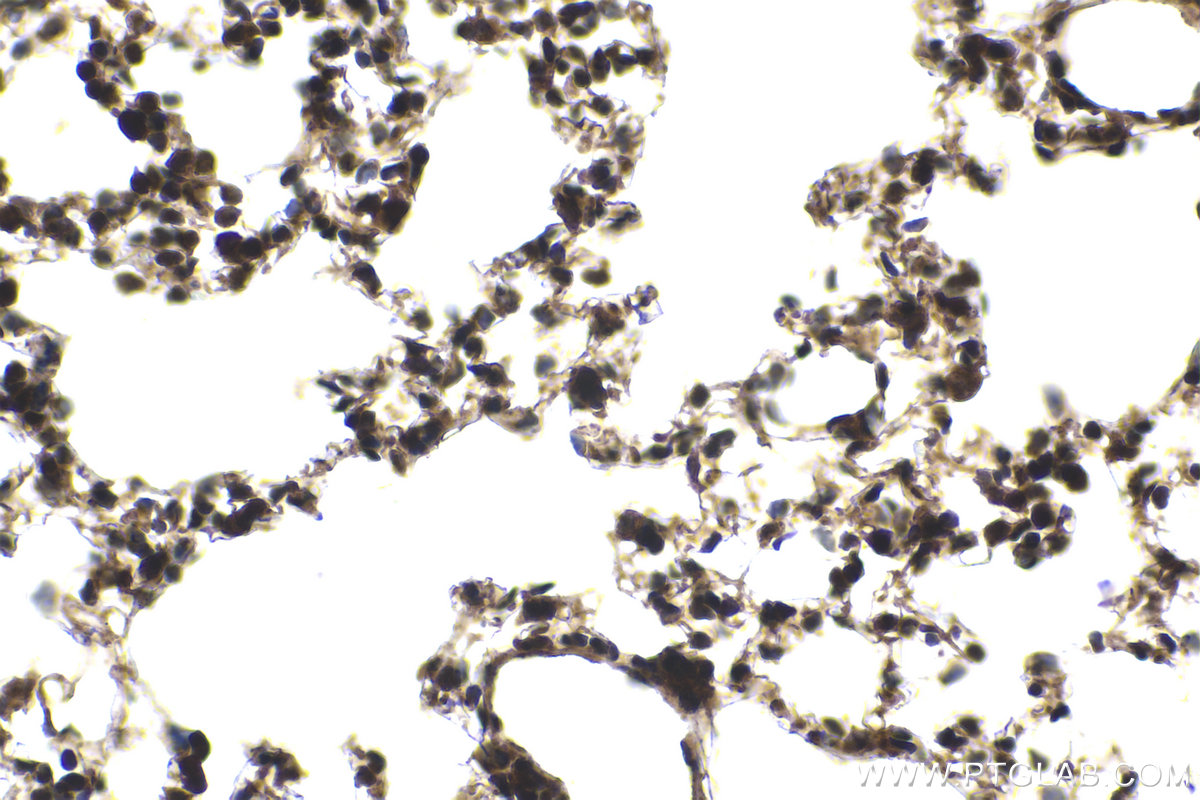 Immunohistochemical analysis of paraffin-embedded mouse lung tissue slide using KHC2052 (UBE2C IHC Kit).