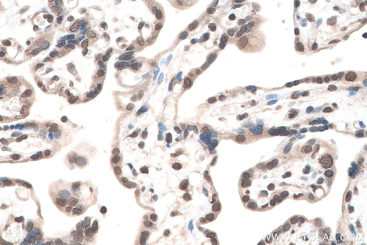 Immunohistochemical analysis of paraffin-embedded human placenta tissue slide using KHC0905 (UBE2I/UBC9 IHC Kit).