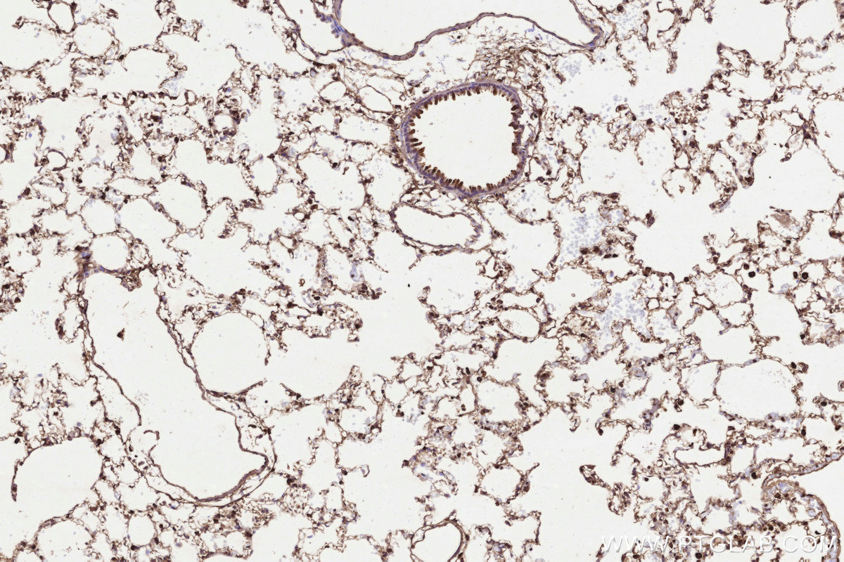 Immunohistochemical analysis of paraffin-embedded rat lung tissue slide using KHC3235 (UBE2M/UBC12 IHC Kit).