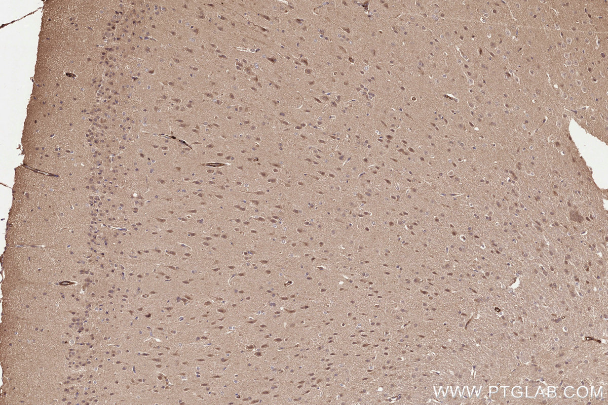 Immunohistochemical analysis of paraffin-embedded rat brain tissue slide using KHC3235 (UBE2M/UBC12 IHC Kit).