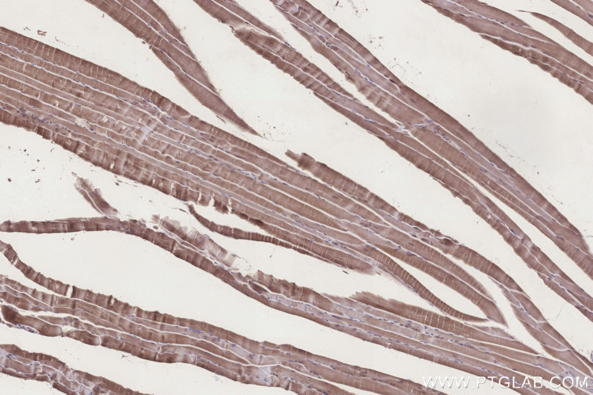Immunohistochemical analysis of paraffin-embedded mouse skeletal muscle tissue slide using KHC3276 (UBE2R2 IHC Kit). Immunohistochemical analysis of paraffin-embedded mouse skeletal muscle tissue slide using KHC3276 (UBE2R2 IHC Kit).