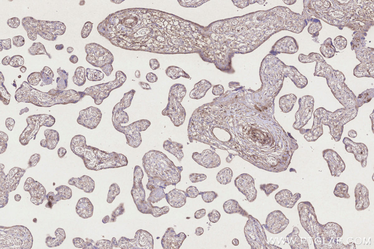 Immunohistochemical analysis of paraffin-embedded human placenta tissue slide using KHC3276 (UBE2R2 IHC Kit). Immunohistochemical analysis of paraffin-embedded human placenta tissue slide using KHC3276 (UBE2R2 IHC Kit).