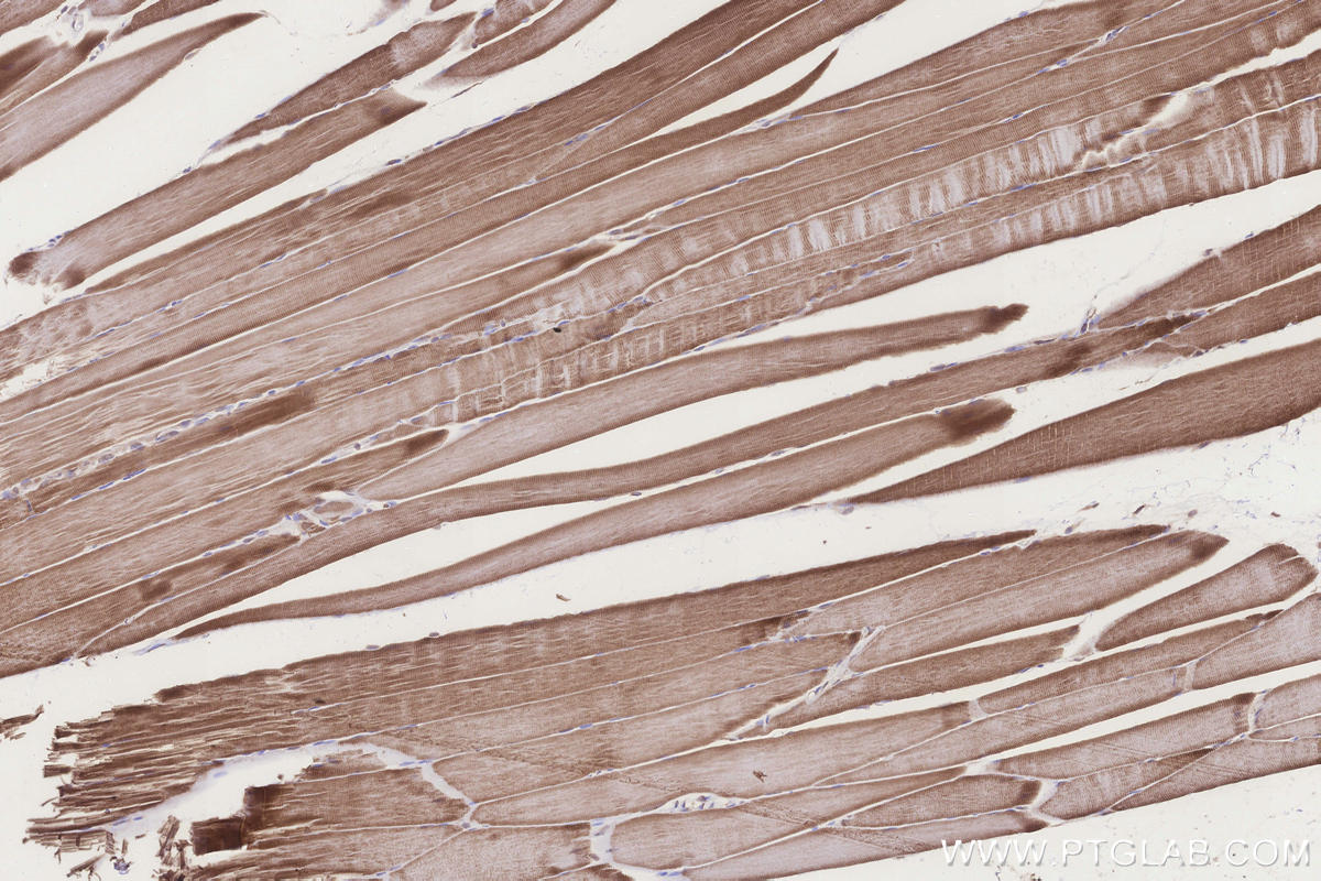 Immunohistochemical analysis of paraffin-embedded rat skeletal muscle tissue slide using KHC3276 (UBE2R2 IHC Kit). Immunohistochemical analysis of paraffin-embedded rat skeletal muscle tissue slide using KHC3276 (UBE2R2 IHC Kit).