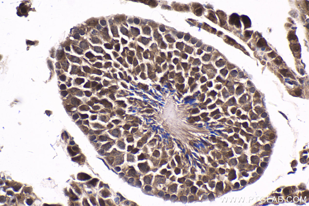 Immunohistochemical analysis of paraffin-embedded mouse testis tissue slide using KHC1602 (UBE3A IHC Kit).