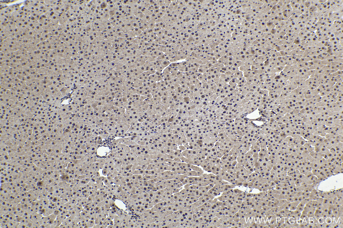 Immunohistochemical analysis of paraffin-embedded rat liver tissue slide using KHC1602 (UBE3A IHC Kit).