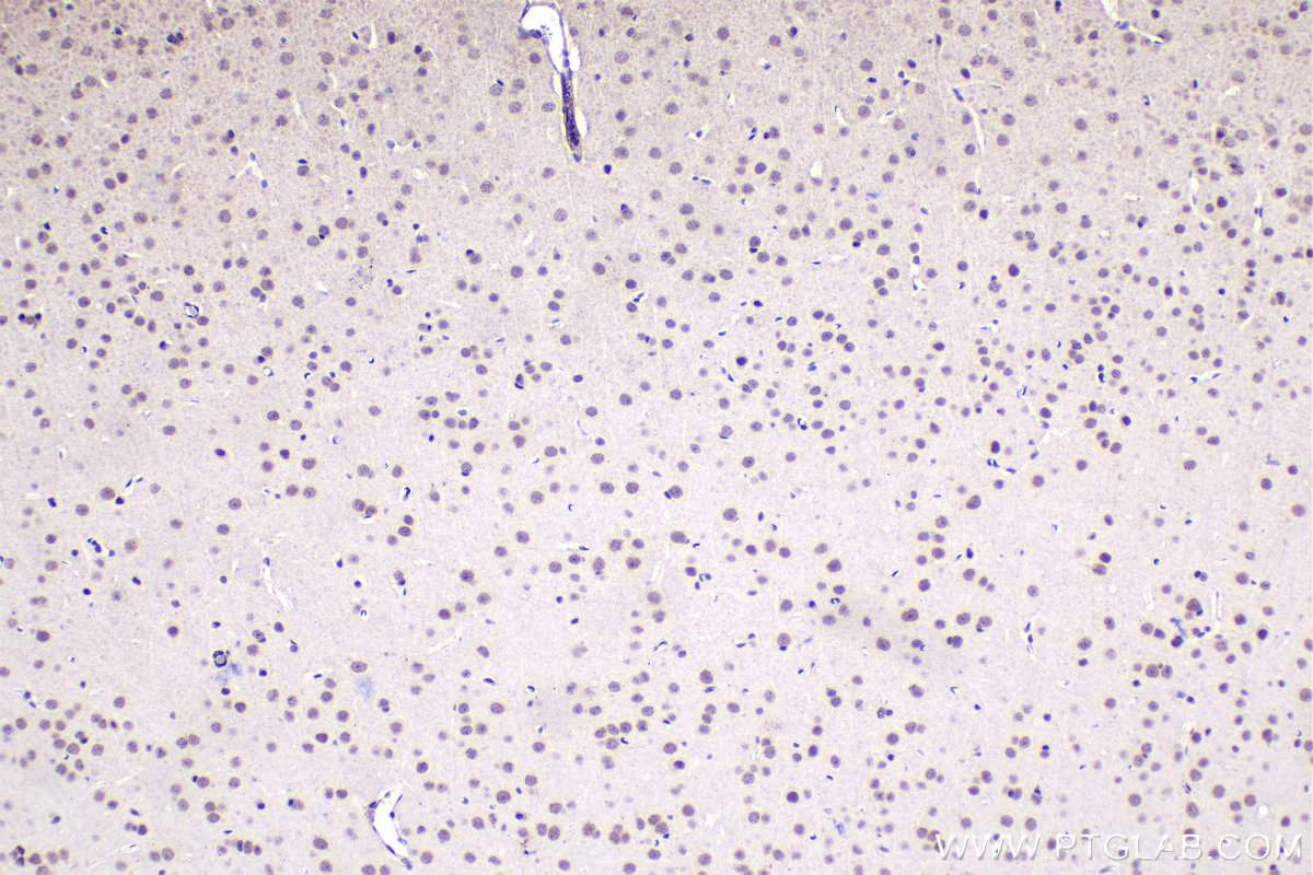 Immunohistochemical analysis of paraffin-embedded mouse brain tissue slide using KHC1490 (UBR5 IHC Kit).