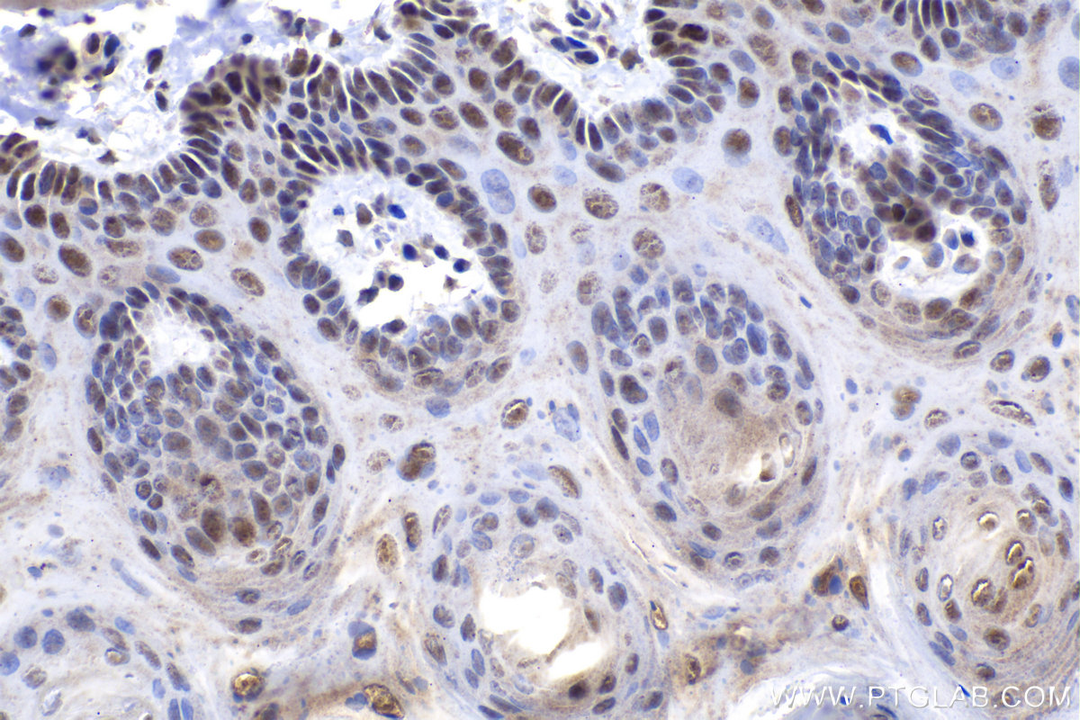 Immunohistochemical analysis of paraffin-embedded rat tongue tissue slide using KHC1490 (UBR5 IHC Kit).