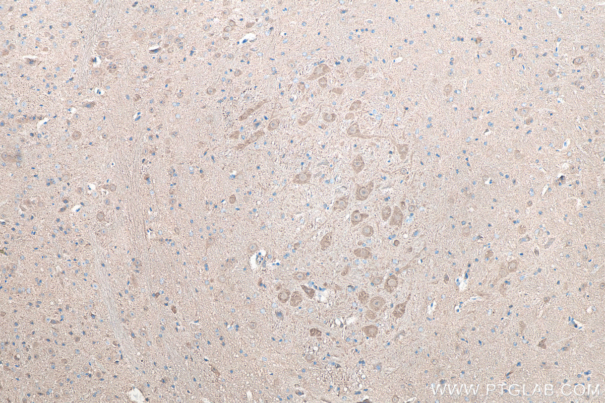 Immunohistochemical analysis of paraffin-embedded mouse cerebellum tissue slide using KHC0054 (UCHL1 IHC Kit).