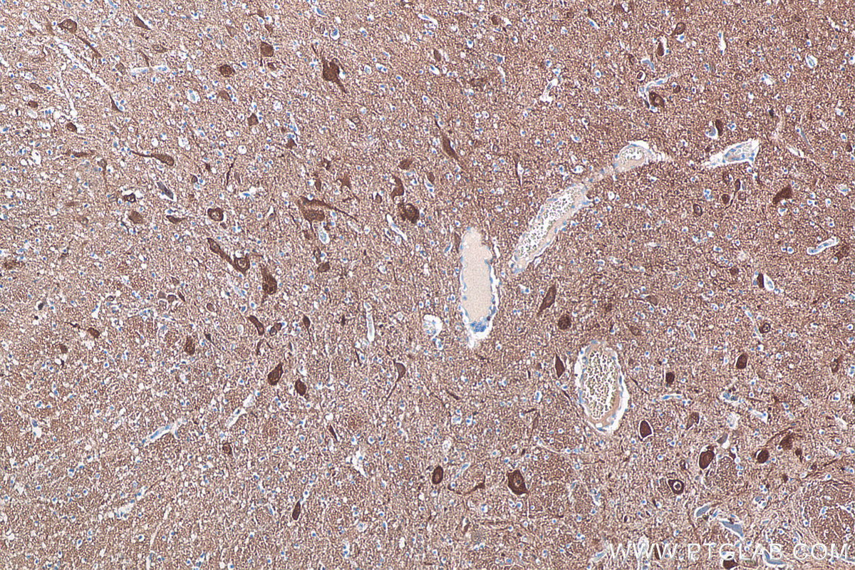 Immunohistochemical analysis of paraffin-embedded human hypothalamus tissue slide using KHC0054 (UCHL1 IHC Kit).