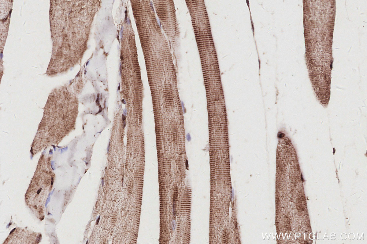 Immunohistochemical analysis of paraffin-embedded mouse skeletal muscle tissue slide using KHC3078 (UCHL5 IHC Kit). Immunohistochemical analysis of paraffin-embedded mouse skeletal muscle tissue slide using KHC3078 (UCHL5 IHC Kit).