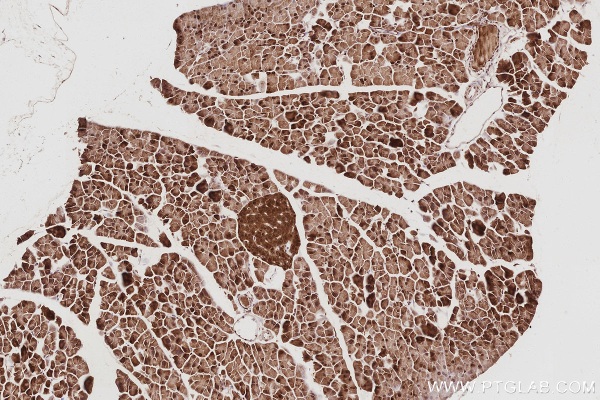 Immunohistochemical analysis of paraffin-embedded mouse pancreas tissue slide using KHC3078 (UCHL5 IHC Kit). Immunohistochemical analysis of paraffin-embedded mouse pancreas tissue slide using KHC3078 (UCHL5 IHC Kit).