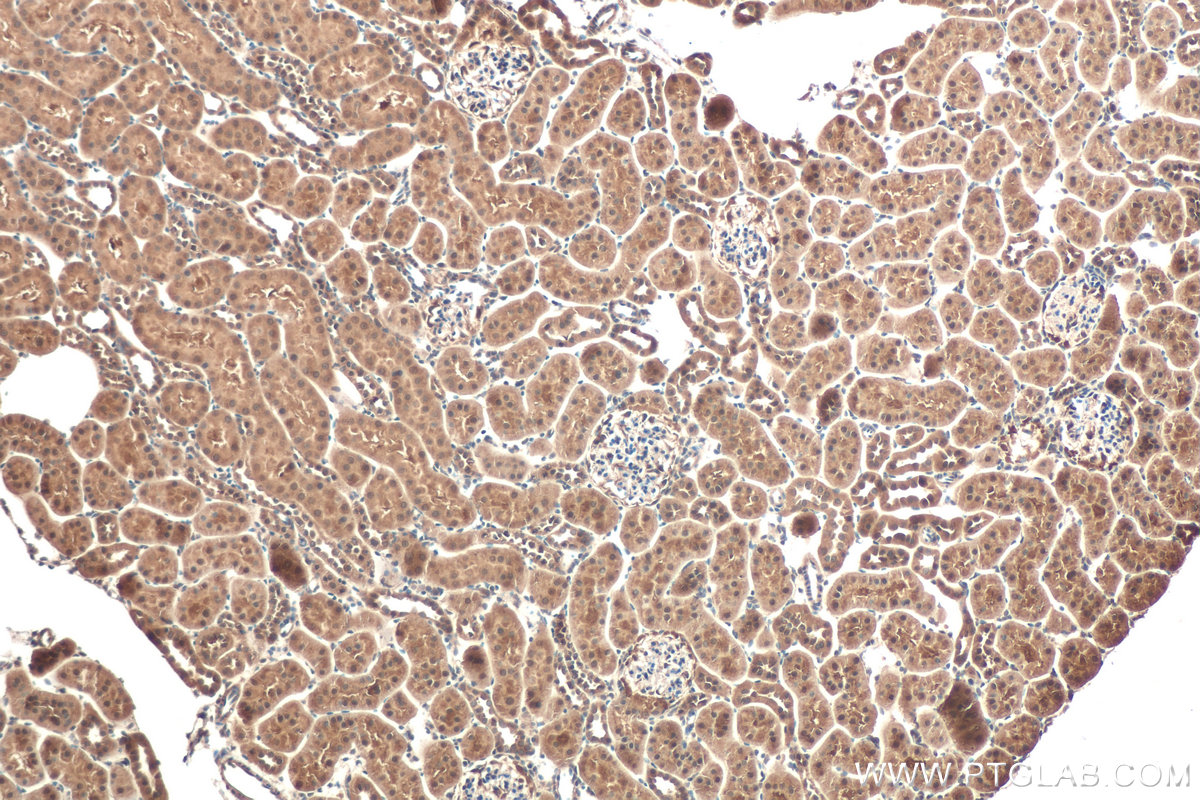 Immunohistochemical analysis of paraffin-embedded rat kidney tissue slide using KHC0949 (UFM1 IHC Kit).