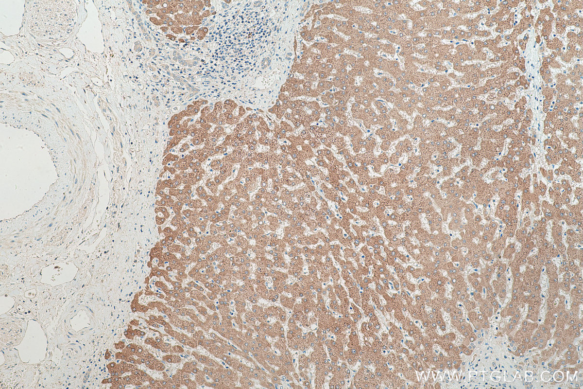 Immunohistochemical analysis of paraffin-embedded human liver tissue slide using KHC0470 (UGT2B4 IHC Kit).