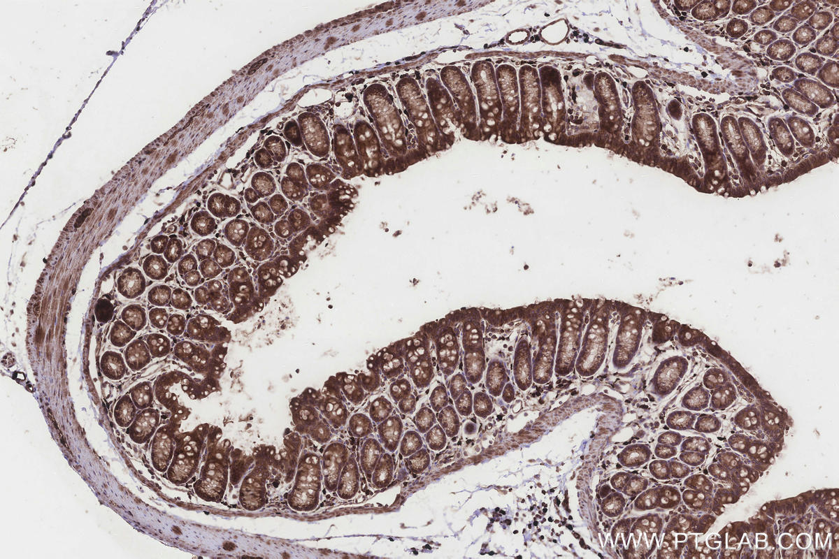 Immunohistochemical analysis of paraffin-embedded mouse colon tissue slide using KHC3258 (UGT8 IHC Kit).