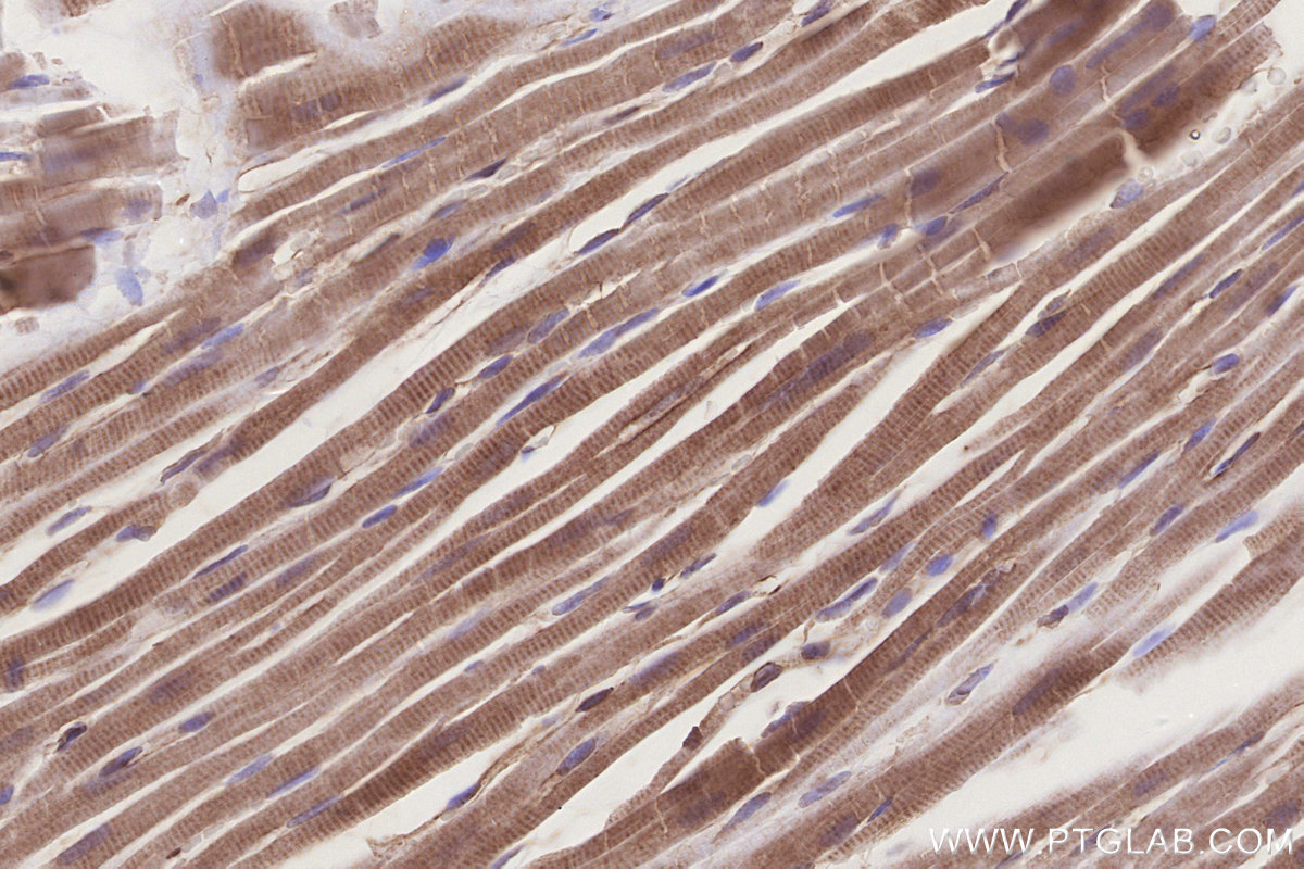 Immunohistochemical analysis of paraffin-embedded rat heart tissue slide using KHC3268 (UHRF1BP1 IHC Kit). Immunohistochemical analysis of paraffin-embedded rat heart tissue slide using KHC3268 (UHRF1BP1 IHC Kit).