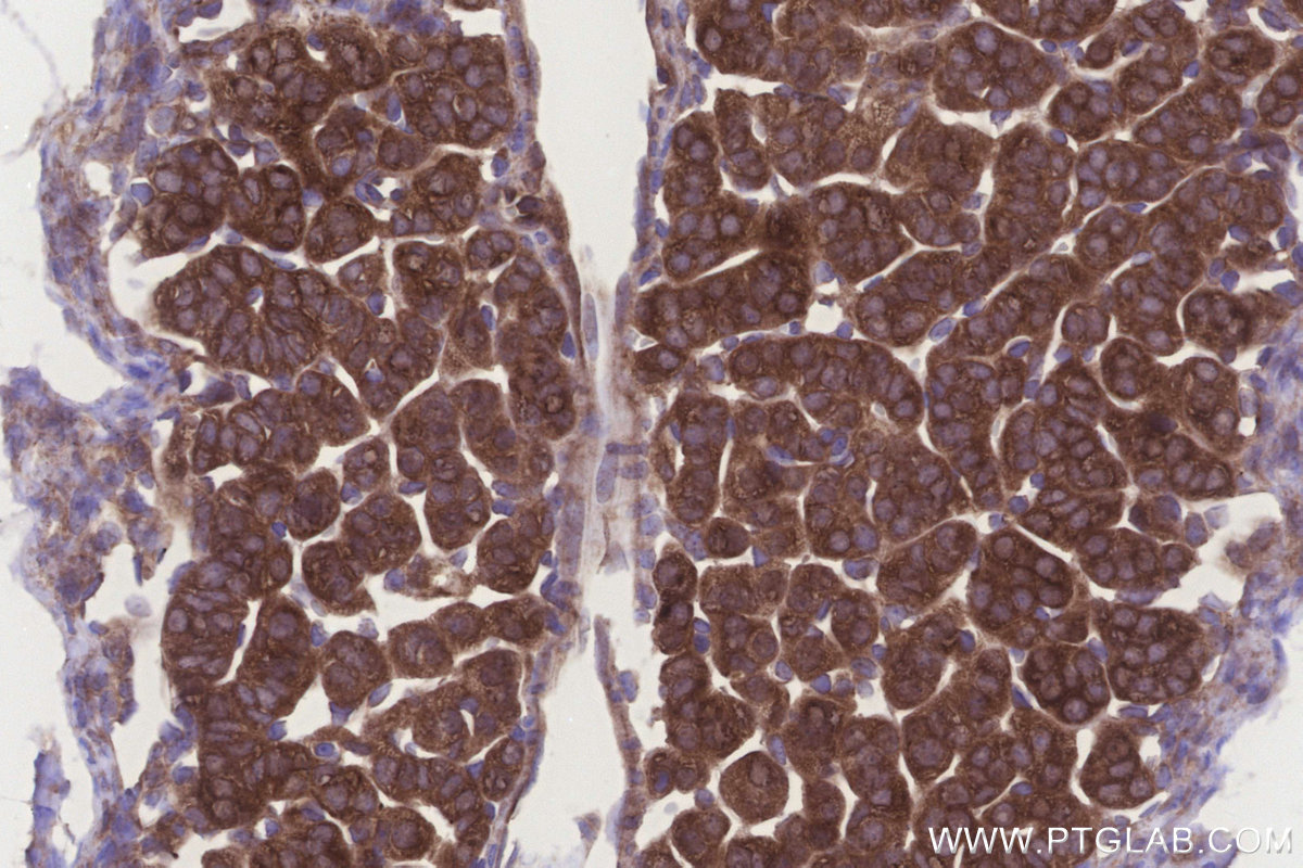 Immunohistochemical analysis of paraffin-embedded mouse adrenal gland tissue slide using KHC3268 (UHRF1BP1 IHC Kit). Immunohistochemical analysis of paraffin-embedded mouse adrenal gland tissue slide using KHC3268 (UHRF1BP1 IHC Kit).