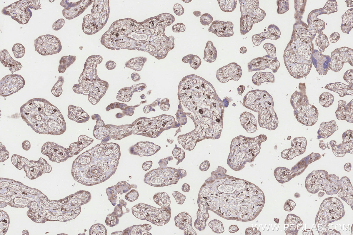 Immunohistochemical analysis of paraffin-embedded human placenta tissue slide using KHC3268 (UHRF1BP1 IHC Kit). Immunohistochemical analysis of paraffin-embedded human placenta tissue slide using KHC3268 (UHRF1BP1 IHC Kit).