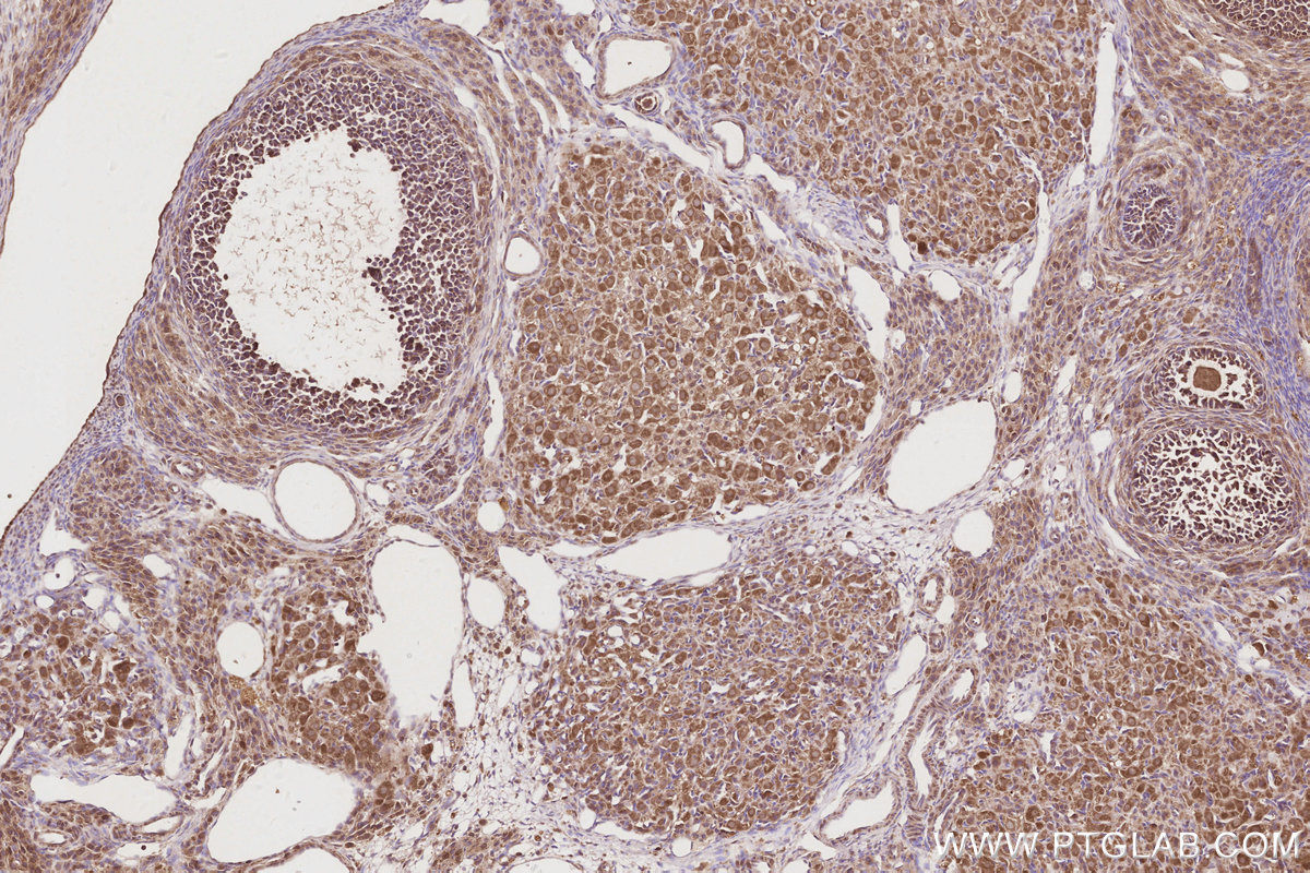 Immunohistochemical analysis of paraffin-embedded rat ovary tissue slide using KHC2913 (UNC45A IHC Kit).