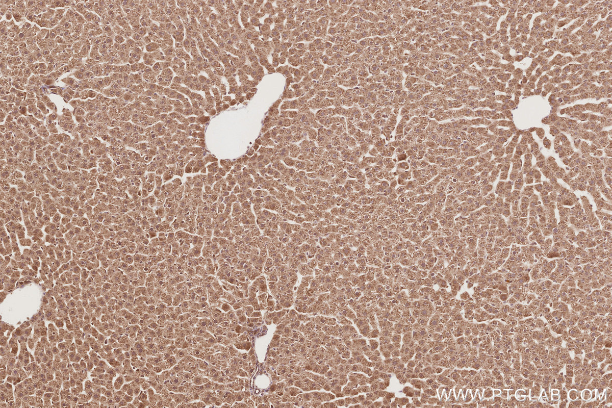 Immunohistochemical analysis of paraffin-embedded rat liver tissue slide using KHC2913 (UNC45A IHC Kit).