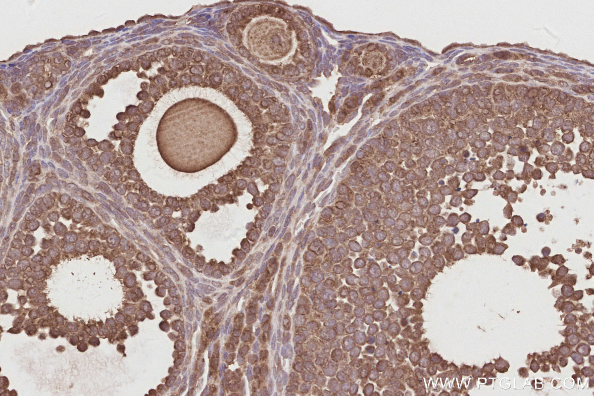 Immunohistochemical analysis of paraffin-embedded mouse ovary tissue slide using KHC2913 (UNC45A IHC Kit).