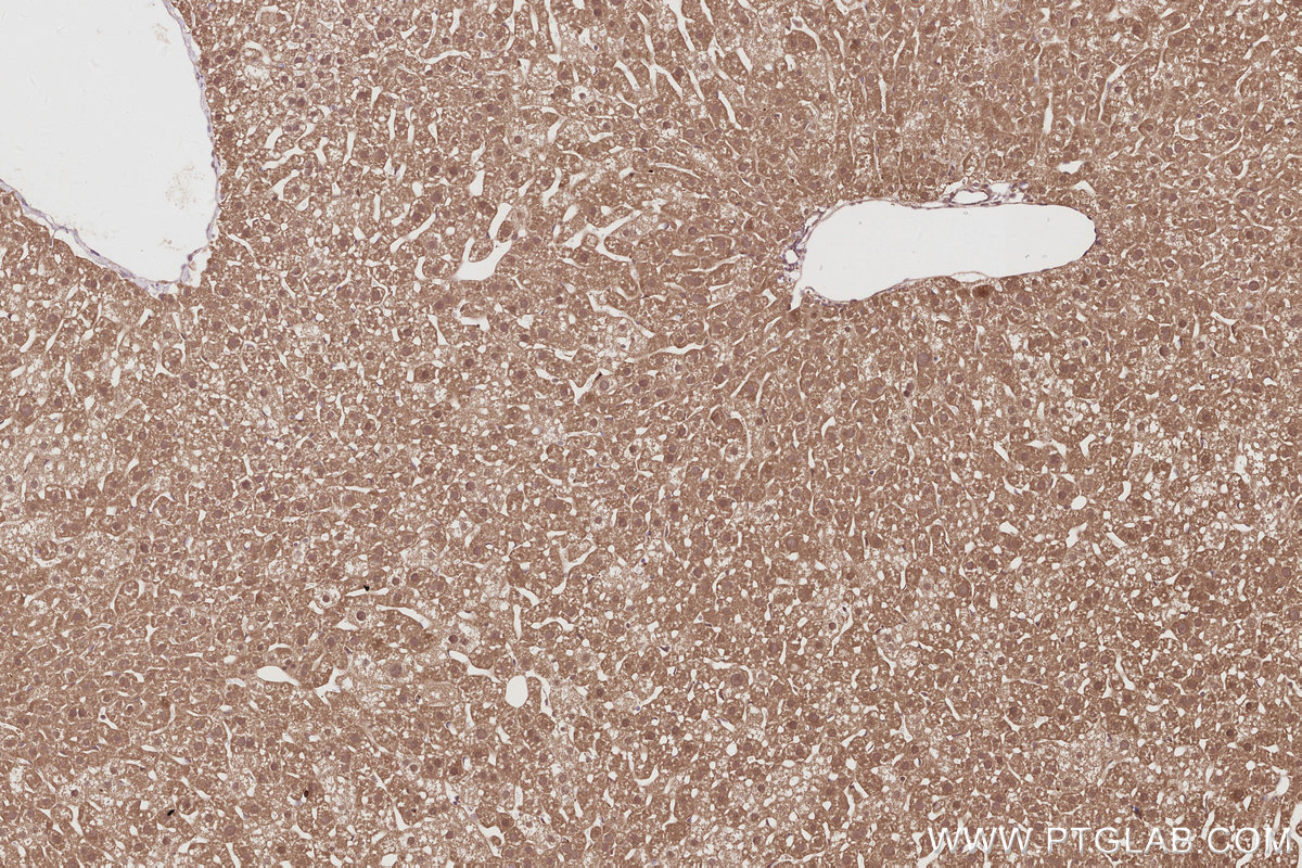 Immunohistochemical analysis of paraffin-embedded mouse liver tissue slide using KHC2913 (UNC45A IHC Kit).