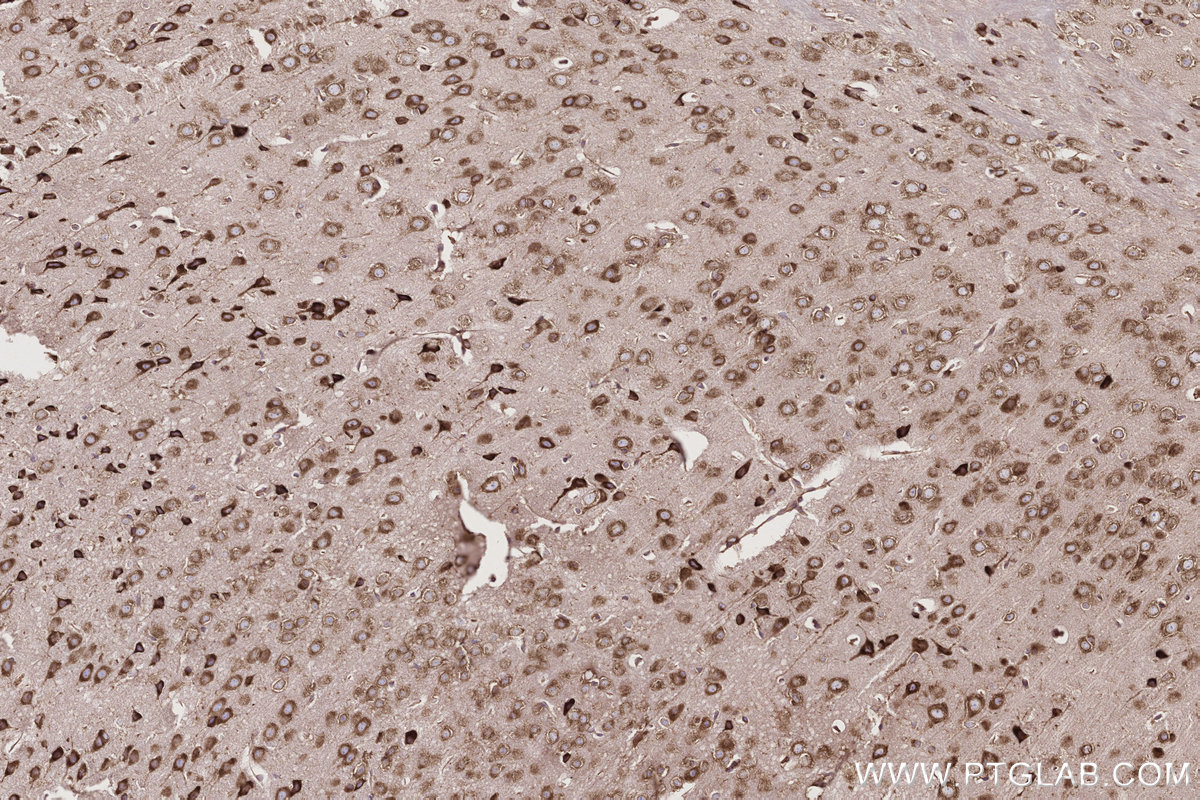 Immunohistochemical analysis of paraffin-embedded mouse brain tissue slide using KHC2765 (UPF1 IHC Kit).