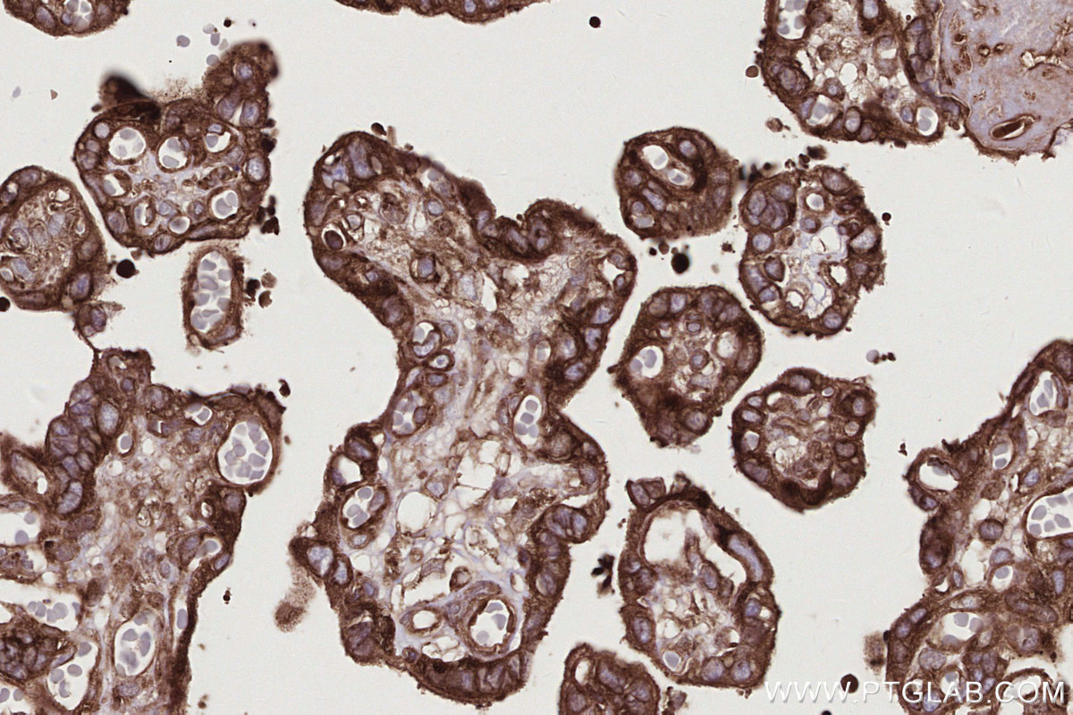 Immunohistochemical analysis of paraffin-embedded human placenta tissue slide using KHC2765 (UPF1 IHC Kit).